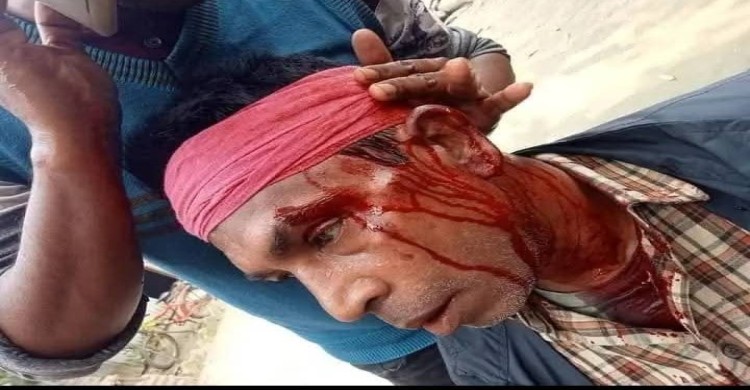 গুলিবিদ্ধ সেচ্ছাসেবক দলের সাবেক আহ্বায়ক জয়নাল আবেদিনের অবস্থা আশঙ্কাজনক, চিকিৎসায় অবহেলার অভিযোগ